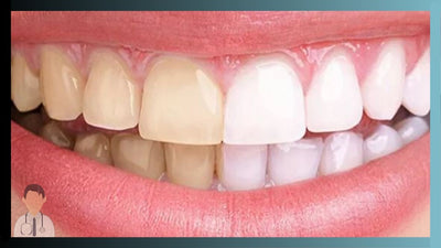 Santé dentaire / Précautions / Recommandations - Dr.Bright